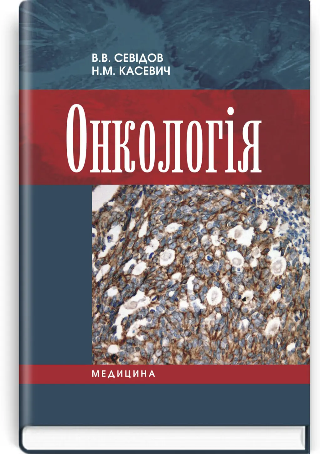 Онкологія: підручник