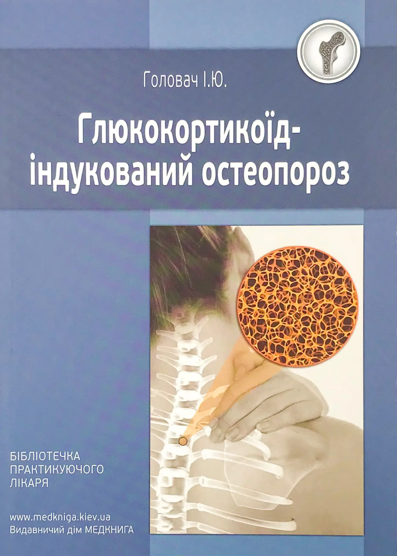 Книга Глюкокортикоїд-індукований остеопороз