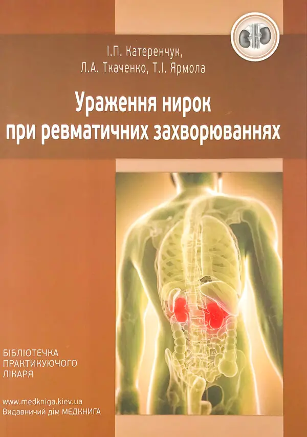 Ураження нирок при ревматичних захворюваннях