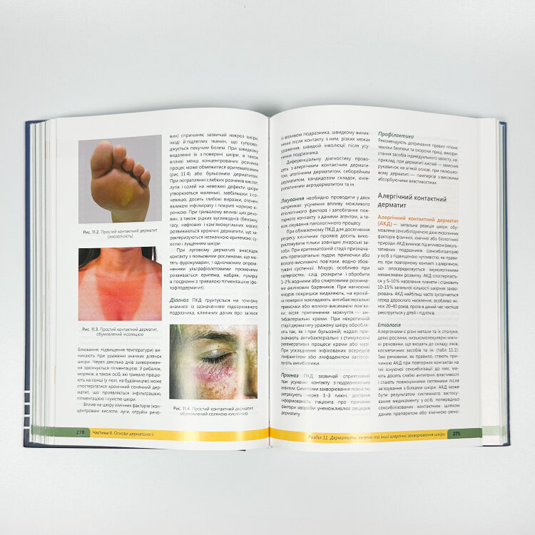 Дерматологія. Венерологія = Dermatology. Venereology: атлас укр. та англ. мовами