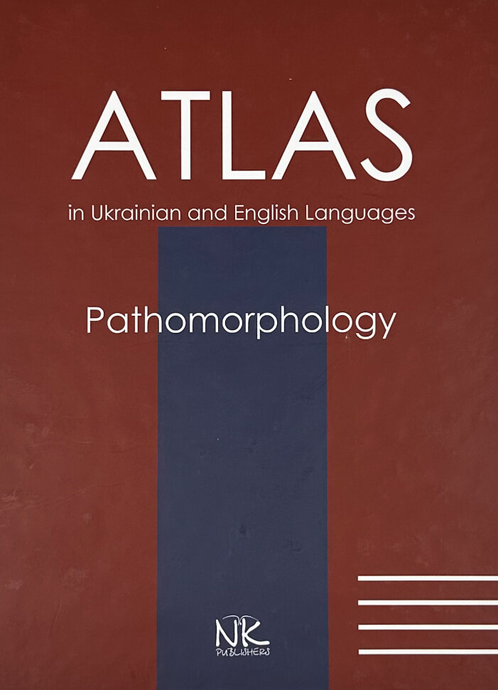 Патоморфологія = Pathomorphology: атлас укр. та англ. мовами. Автор — Боднар Я.Я., Багрій М.М.. Обкладинка — Тверда
