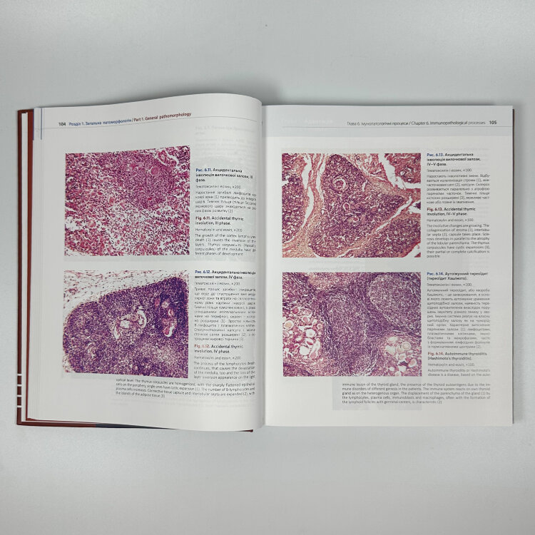 Патоморфологія = Pathomorphology: атлас укр. та англ. мовами
