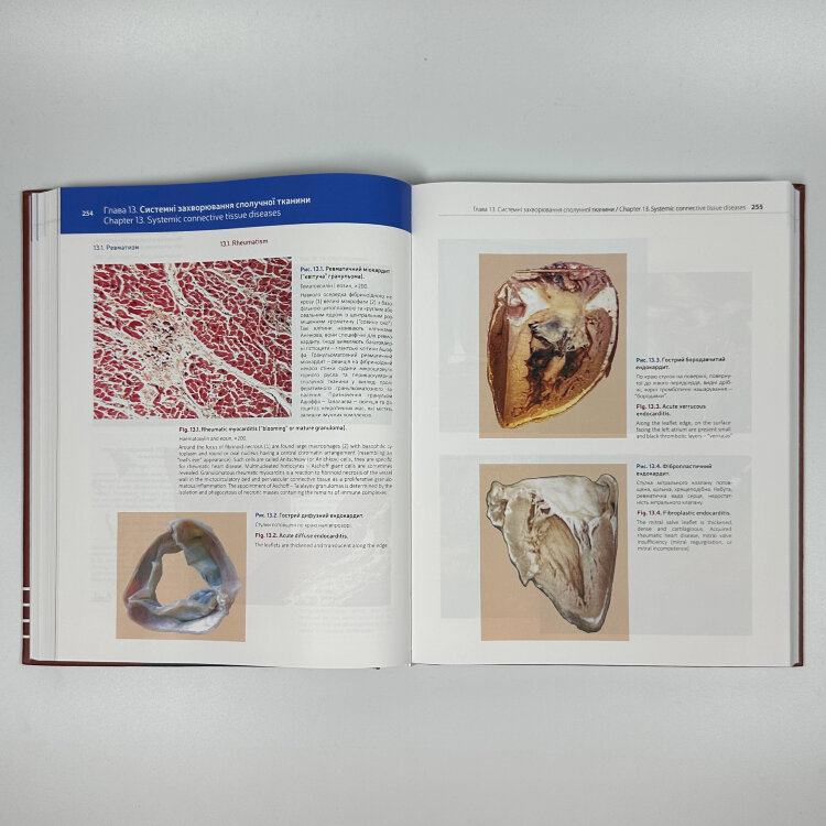 Патоморфологія = Pathomorphology: атлас укр. та англ. мовами