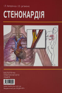 Стенокардія