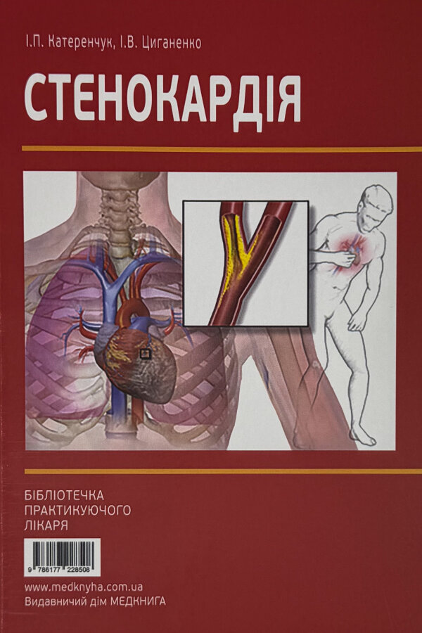 Стенокардія