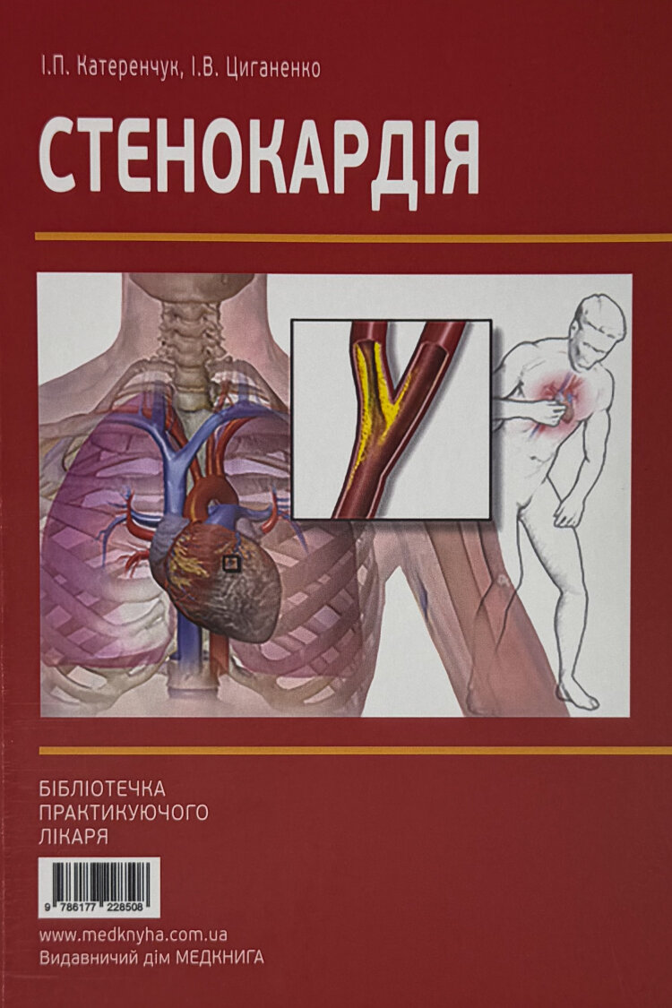 Стенокардія