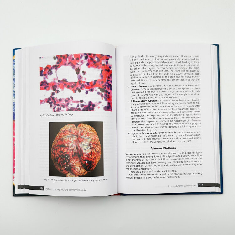 Pathomorphology. General Pathomorphology 