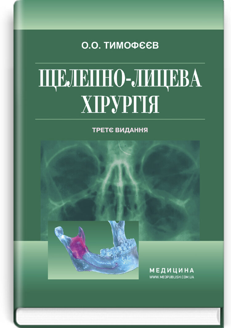 Щелепно-лицева хірургія: підручник