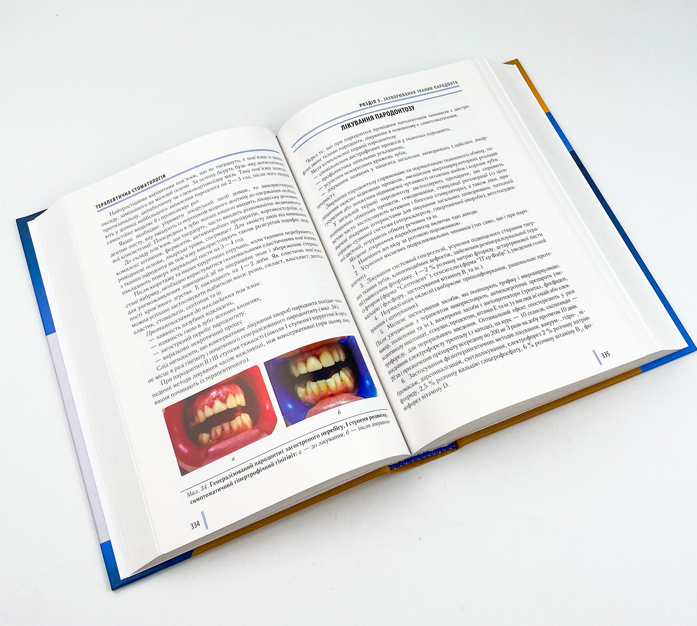 Стоматологія. Книга 2. Автор — М.М Рожко, І.І Кириленко, О.Г Денисенко. 