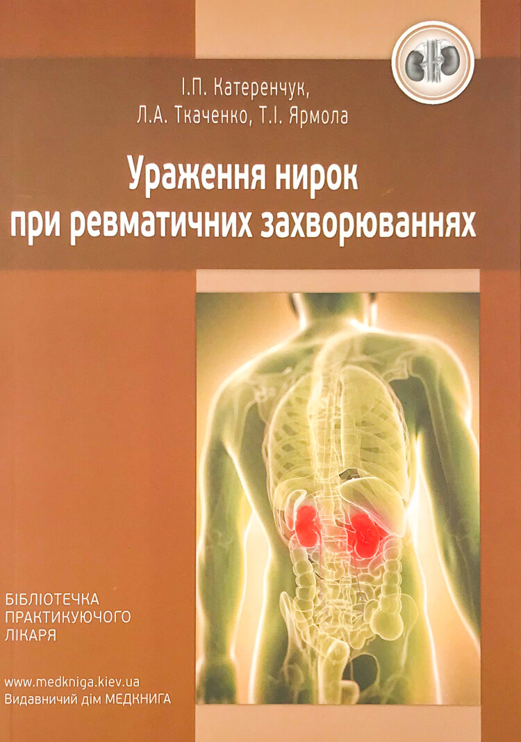 Ураження нирок при ревматичних захворюваннях