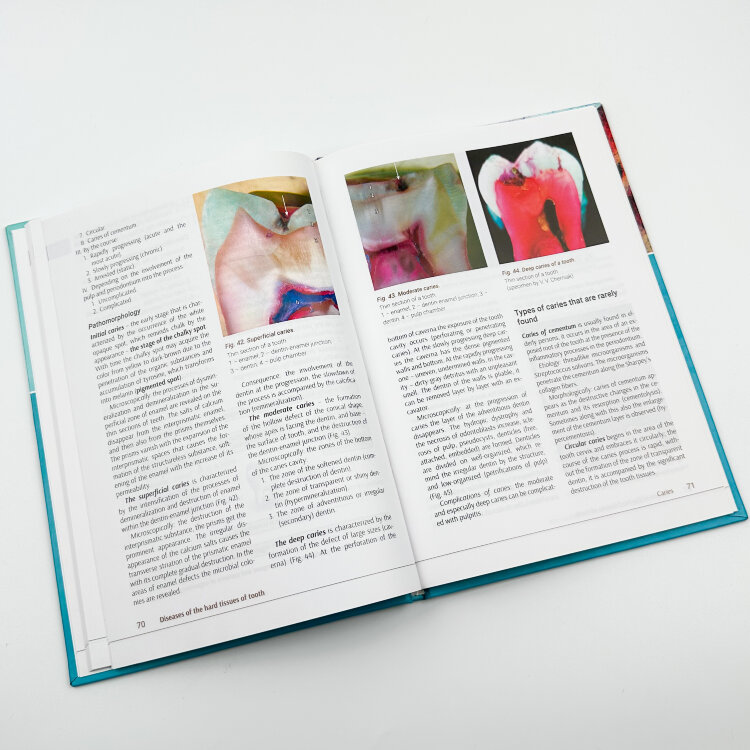 Pathomorphology of Сommon Diseases of Maxillofacial Area