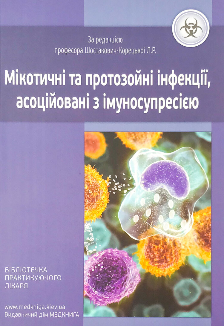 Мікотичні та протозойні інфекції, асоційовані з імуносупресією