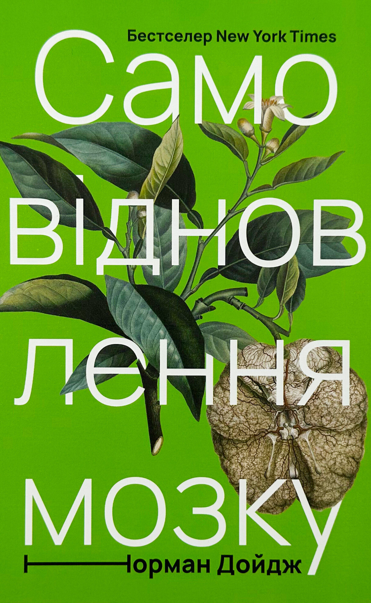 Самовідновлення мозку